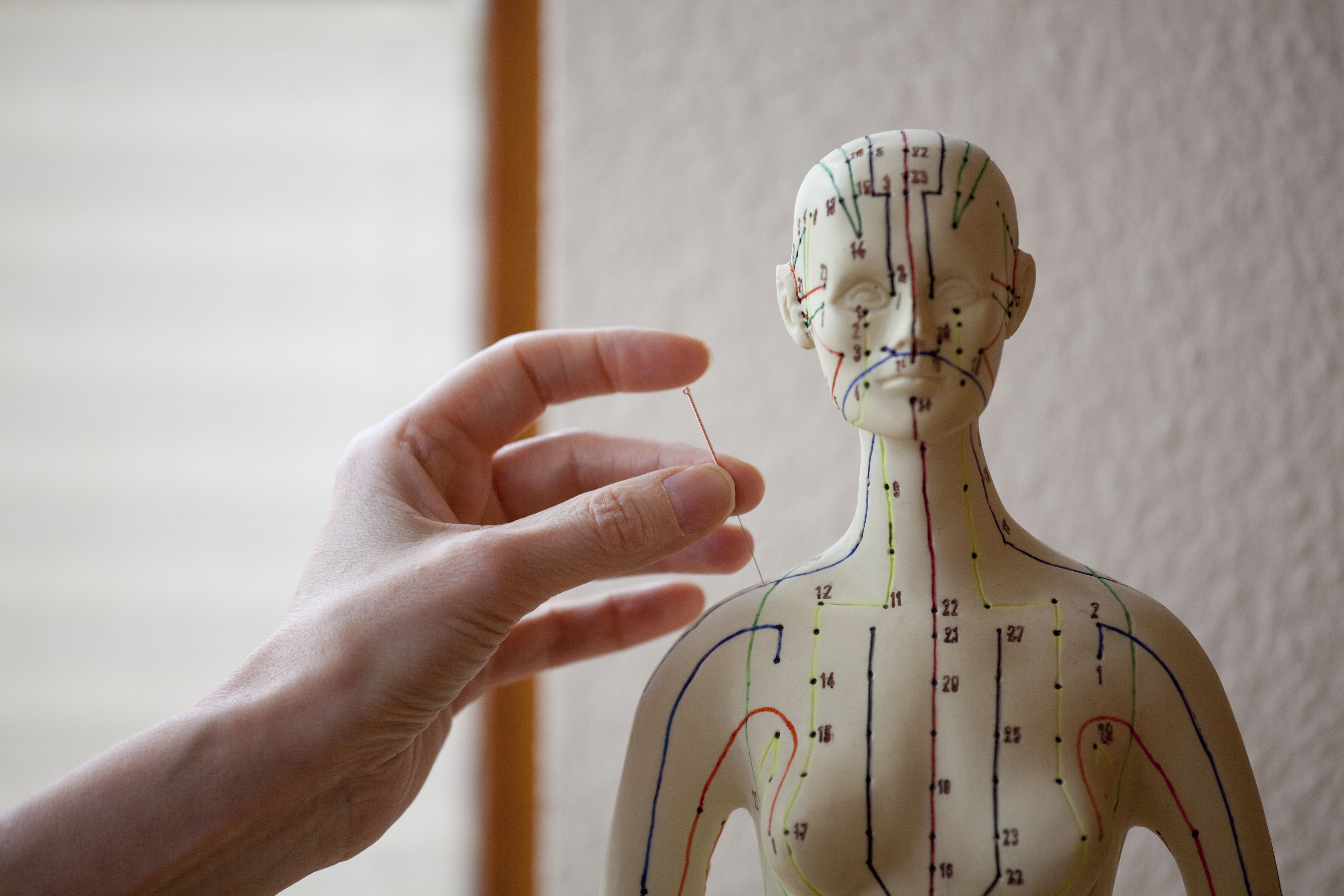Figur mit Akkupunkturnadeln